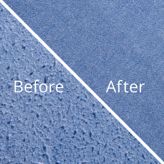 آلة إزالة الوبر – نتائج فورية ورجع ملابسك جديدة 😍😍